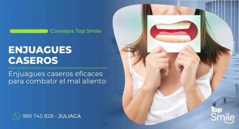 Enjuagues caseros para el mal aliento