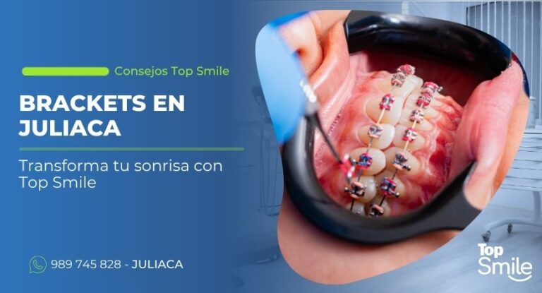 Brackets en Juliaca