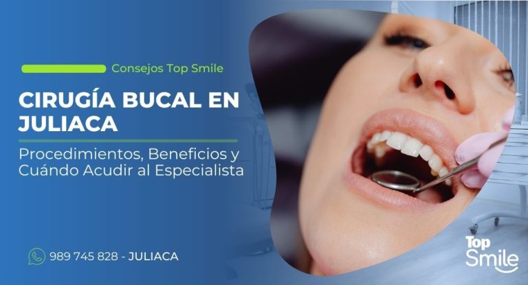 cirugía bucal en Juliaca