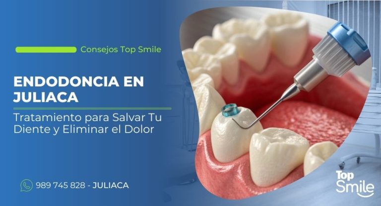 endodoncia en Juliaca