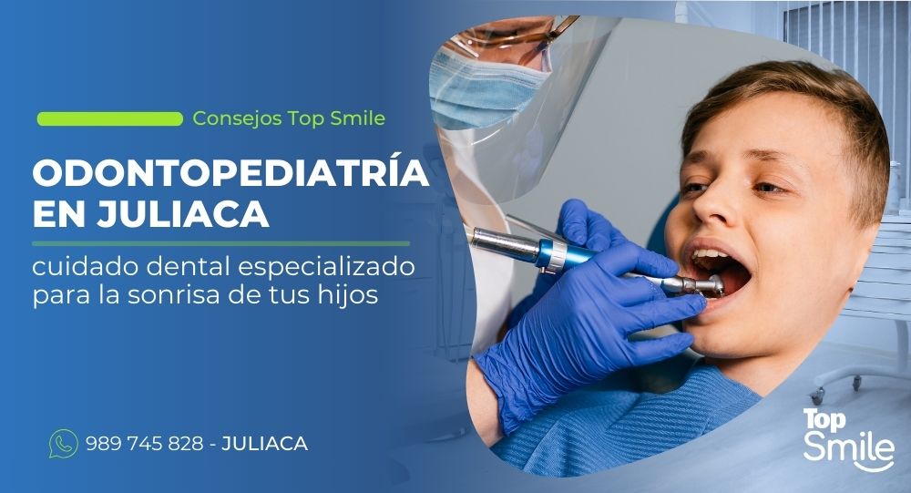 odontopediatría en Juliaca