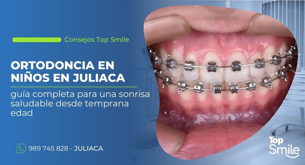 Ortodoncia en Juliaca