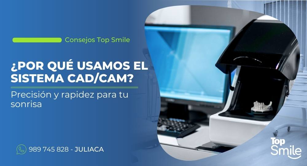 sistema CAD/CAM en Juliaca
